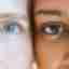 Soin cryo regard